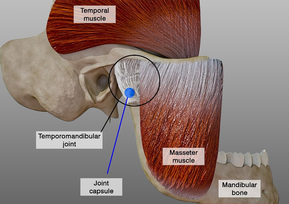 Diagram explaining the temporomandibular joint and surrounding areas